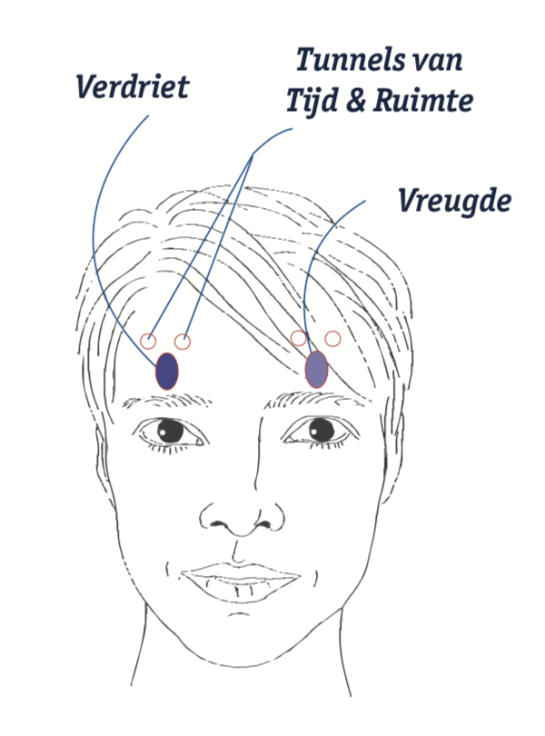 migraine, vreugde, verdriet, drukpunten, hoofd, hoofdpijn, klachten